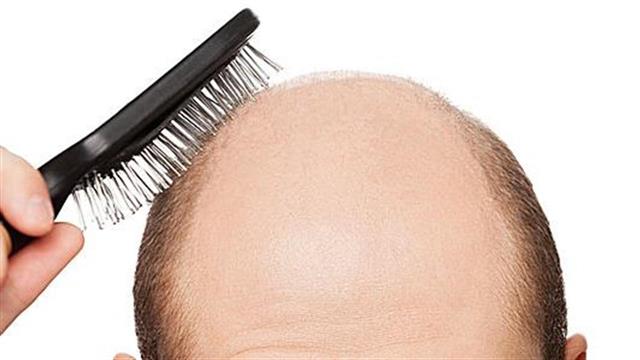 Υποσχόμενη μέθοδος για την τριχόπτωση