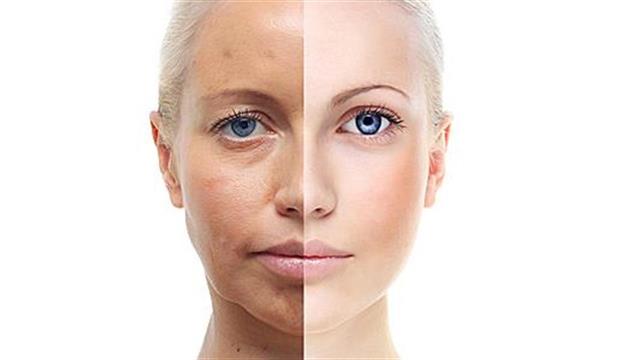 Ποιοι παράγοντες επιταχύνουν τη γήρανση