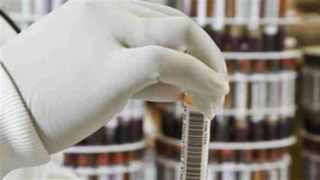 ΠΕΙΒ: Η εργαστηριακή Ιατρική παραδίδεται στους μεγάλους επιχειρηματικούς ομίλους