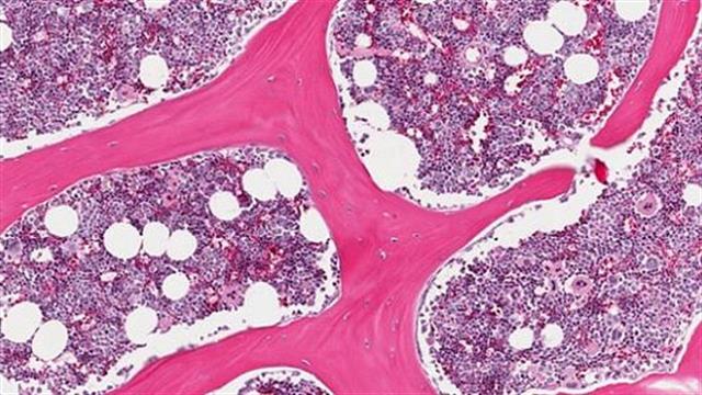 Ερευνητές αναπτύσσουν τεχνητό μυελό των οστών