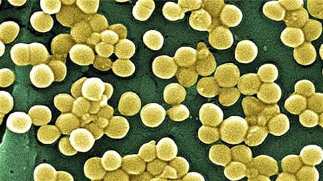 Roche: Νέο τεστ ανιχνεύει τις σοβαρότερες ενδονοσοκομειακές λοιμώξεις