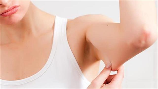 Ξεφορτωθείτε το λίπος από τους τρικέφαλους