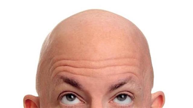 Τριχόπτωση: Τα είδη των θεραπειών