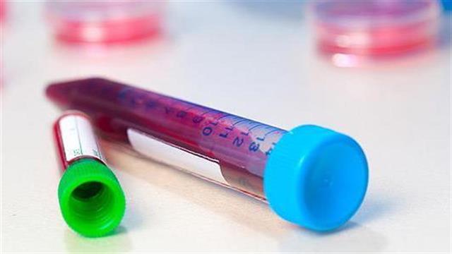 AIDS: Πιο κοντά το τζελ προστασίας των γυναικών