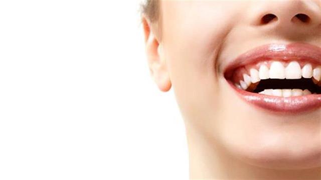 Ουλίτιδα : Τι είναι και πώς αντιμετωπίζεται η χαλάρωση των ούλων