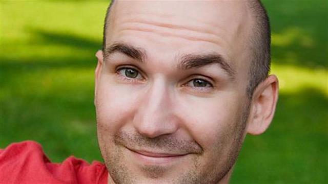 Φάρμακο κατά της αρθρίτιδας επανέφερε την τριχοφυΐα σε ασθενή με καθολική αλωπεκία