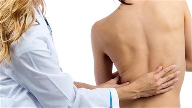 Εντοπίστηκαν γονίδια που συνδέονται με την σκολίωση