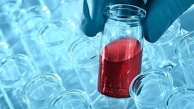 Sanofi: Σε αναζήτηση αγοραστή για 200 φάρμακα χωρίς πατέντα