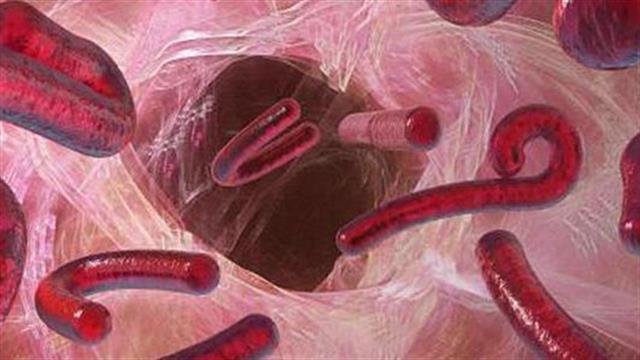 Ύποπτο θανατηφόρο κρούσμα του ιού Έμπολα στην ΠΓΔΜ