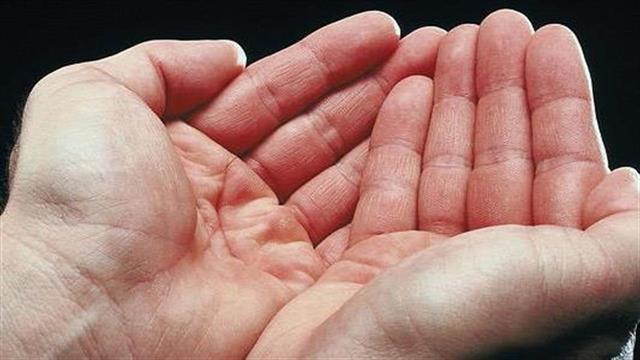 Με πρόωρο τοκετό συνδέεται η ρευματοειδής αρθρίτιδα στις γυναίκες