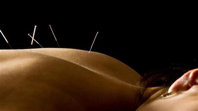 Είναι επικίνδυνος ο βελονισμός;