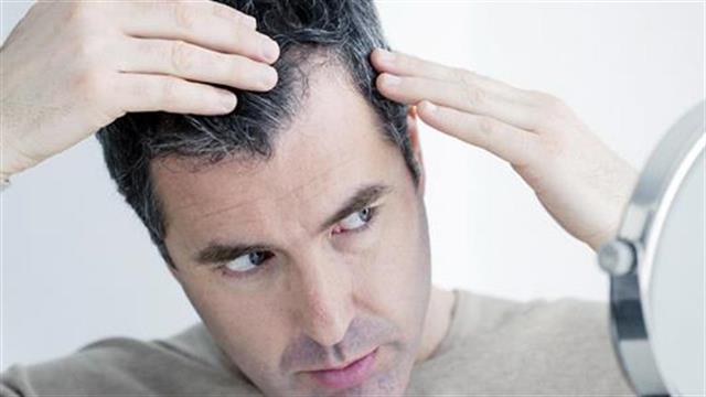 Το αποτέλεσμα μετά την εμφύτευση μαλλιών