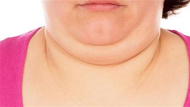 Προς έγκριση εμβόλιο κατά του διπλοσάγονου;