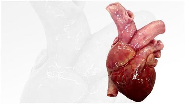 Ωνάσειο: Διάλεξη ‘’3d εκτύπωση και οι εφαρμογές της στην Ιατρική’’