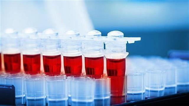 Γρήγορο τεστ αίματος θα περιορίζει τη χρήση αντιβιοτικών