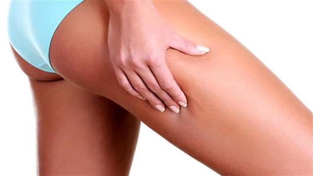 Απαλλαγείτε από την κυτταρίτιδα με απλές λύσεις