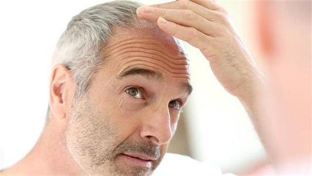 Έρευνα συνδέει τη φαλάκρα με τον κίνδυνο για καρκίνο στον προστάτη