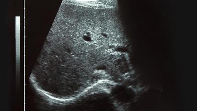 Ερευνητές ανέπτυξαν συσκευή υπερήχων σε μέγεθος τσέπης