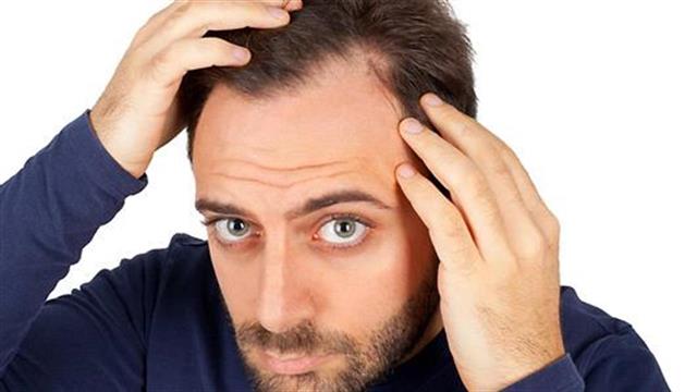 Φάρμακο για την αρθρίτιδα αποτελεσματικό στη θεραπεία της αλωπεκίας