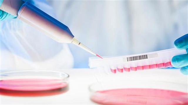 Έναρξη θεραπείας αμέσως μετά τη διάγνωση του HIV συνιστούν τα αποτελέσματα μεγάλης κλινικής μελέτης