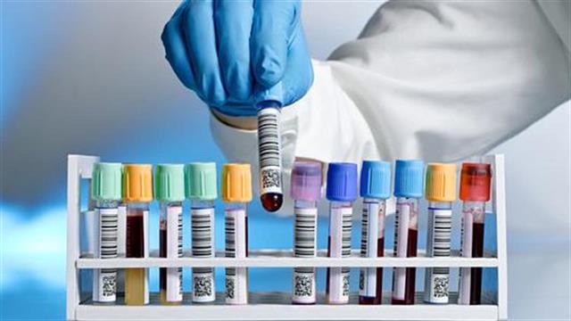 Εντοπίστηκε πρωτεΐνη που καταστέλλει το βιολογικό ρολόι