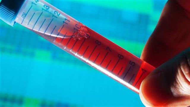 Ποια ομάδα αίματος προστατεύει από τη νόσο Alzheimer;