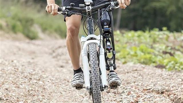 Τεχνητό μέλος που νιώθει