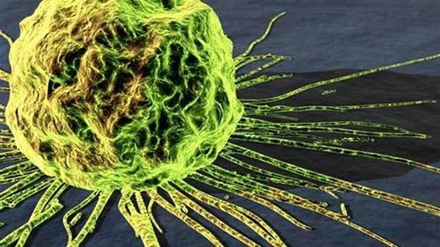 Νόσος του Πάρκινσον: Συνδέεται με 16 είδη καρκίνου