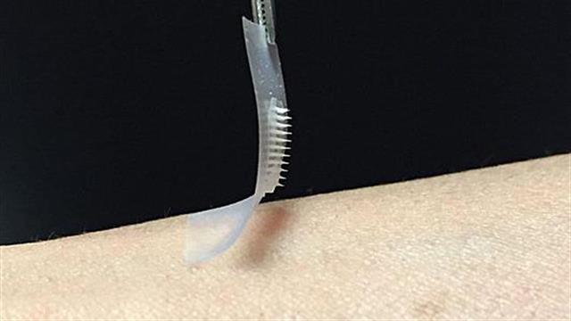 Διαβήτης: Αναπτύχθηκε ‘’έξυπνο’’ επίθεμα ινσουλίνης