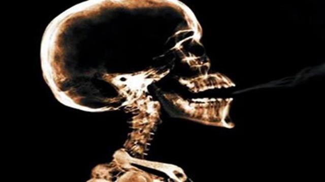 Δεν προκαλεί κατάθλιψη και καρδιακά επεισόδια η βαρενικλίνη για τη διακοπή του καπνίσματος