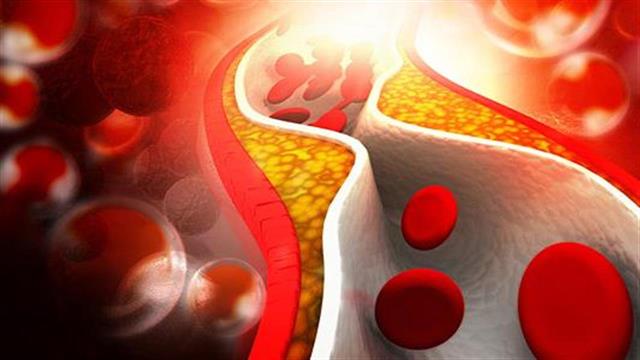 Το alirocumab έλαβε Ευρωπαϊκή έγκριση για τη θεραπεία της υπερχοληστερολαιμίας