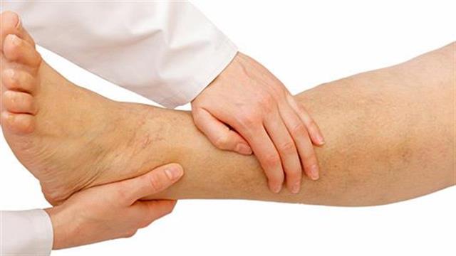 Θρόμβωση: Σκοτώνει έναν στους τέσσερις ανθρώπους σε όλο τον κόσμο