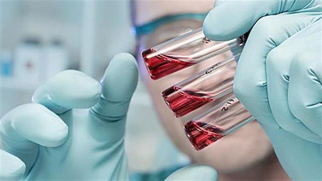 Πιο κοντά εξέταση αίματος για τη νόσο Alzheimer