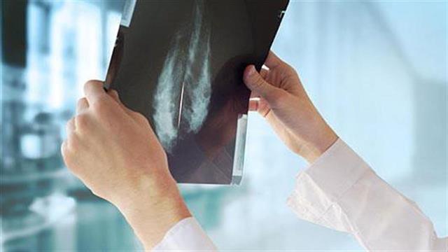 Τι δηλώνει η Πρόεδρος της Ελληνικής Εταιρείας Απεικόνισης Μαστού για τις μαστογραφίες