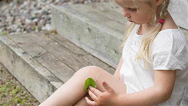 Παροδική υμενίτιδα του ισχίου στα παιδιά: Διάγνωση και θεραπεία