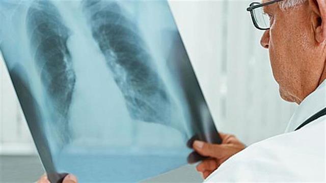 ΙΣΑ: Σε οριακό σημείο η λειτουργία του ακτινολογικού τμήματος του ΓΝΕ Θριάσιο