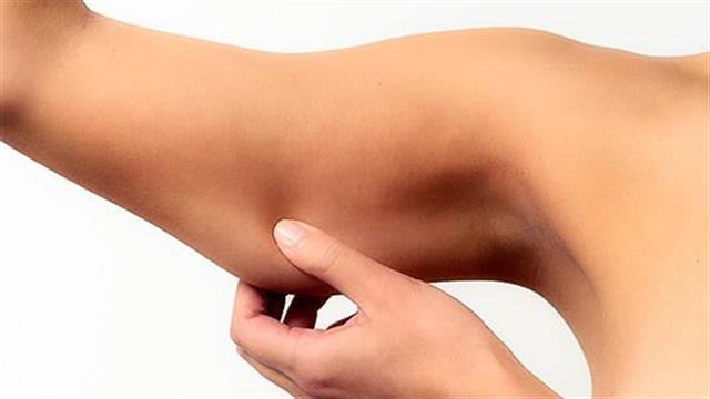 Όταν τα μπράτσα χαλαρώνουν: Η λύση της αισθητικής χειρουργικής