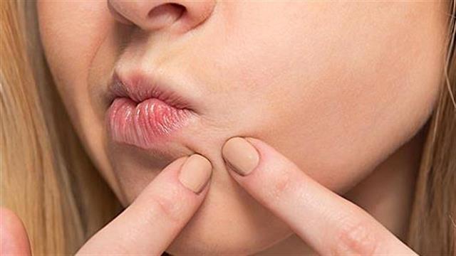 Πώς καταστρέφουμε το δέρμα μας χωρίς να το καταλαβαίνουμε