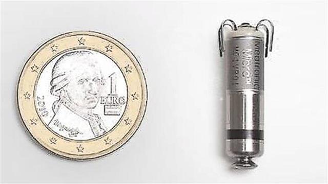 ΥΓΕΙΑ: Εμφύτευση βηματοδότη χωρίς ηλεκτρόδια