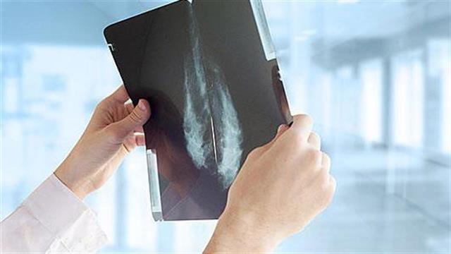 Οι τακτικές μαστογραφίες ωφελούν ηλικιωμένες γυναίκες