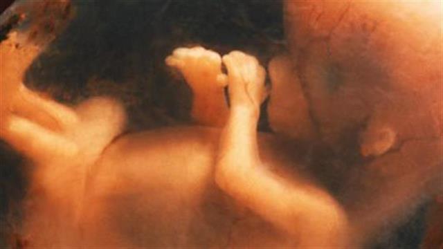 Δώδεκα έμβρυα σε φορμόλη σε κάδο στους Αμπελόκηπους!