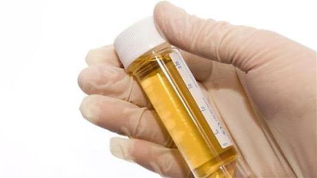 Αναπτύσσεται εξέταση ούρων που μυρίζει τον καρκίνο στον προστάτη