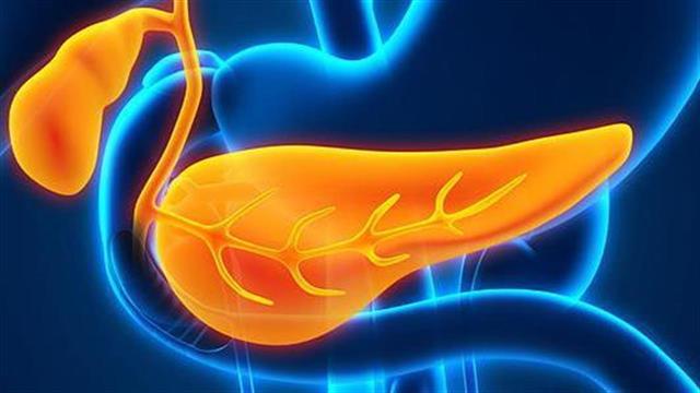 Ο καρκίνος στο πάγκρεας είναι 4 νόσοι