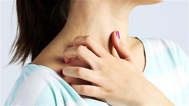 Κνησμός: Νευροδερματίτιδα και άλλα αίτια