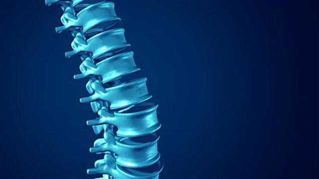 Κήλη μεσοσπονδυλίου δίσκου: Η κατάλληλη άσκηση μπορεί να αποτρέψει το χειρουργείο