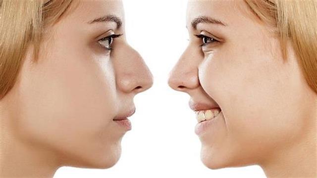 Μύθοι και πραγματικότητα για τη ρινοπλαστική