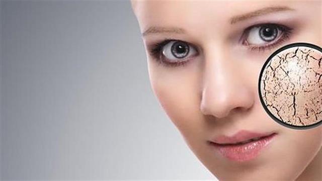 Έρευνα: Η βιταμίνη B3 βελτιώνει το ξηρό δέρμα