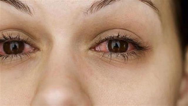 23 Ιουλίου: Παγκόσμια Ημέρα του Sjogren