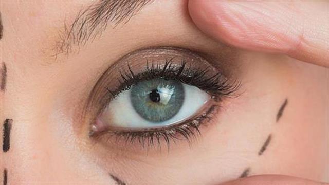 Βλεφαροπλαστική και ανόρθωση φρυδιών