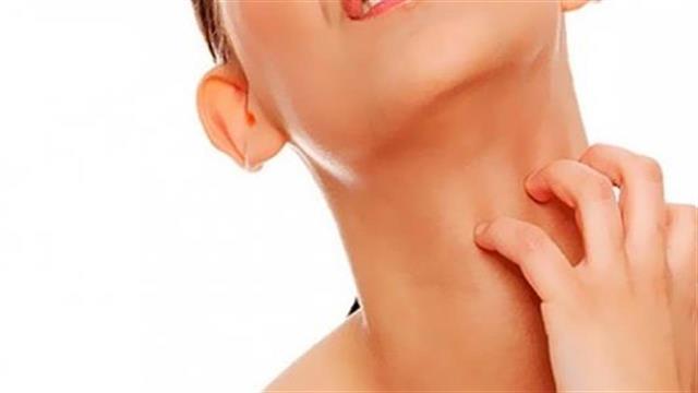 Αλλεργίες και αναφυλαξία το καλοκαίρι